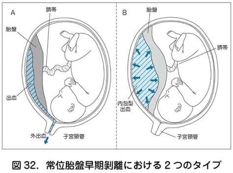 胎盤形成時期|【医師監修】胎盤の役割・構造は？完成する時期や変。